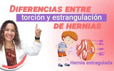 Diferencia entre torsión y estrangulamiento de hernia